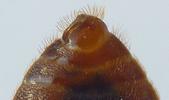 Punaise des lits (Cimex lectularius), extrémité abdominale mâle.