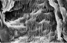 oesophage de termite (microscopie à balayage)